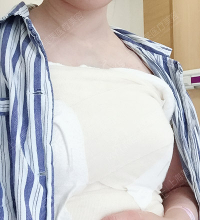 Vicky丰胸