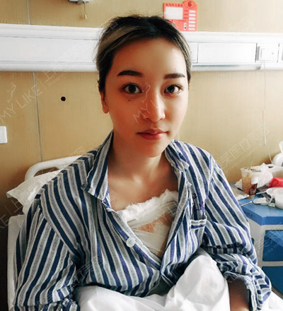 张佳佳术后