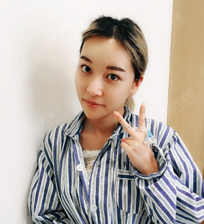 张佳佳术后