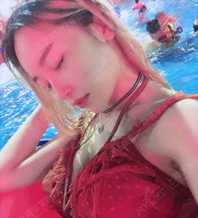 张佳佳丰胸