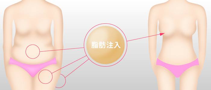 <a href='/tj/' target='_blank'><u>天津利来国际</u></a>自体脂肪丰胸为你打造动感美胸