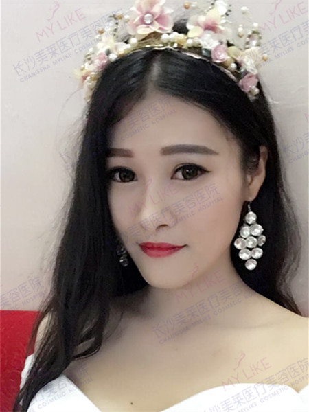 利来国际案例娜娜对比图后