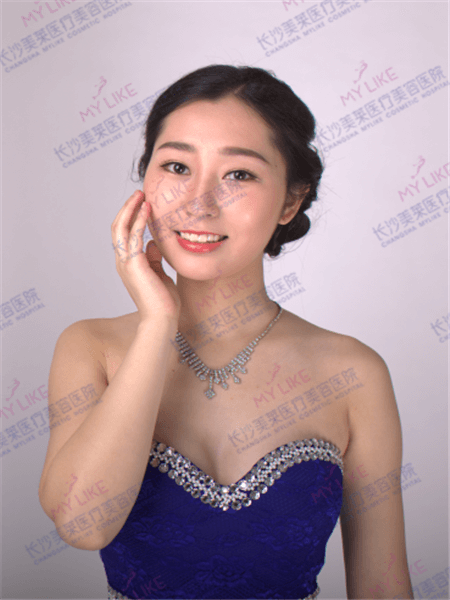 利来国际案例晓雪对比图后