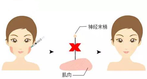 武汉利来国际瘦脸需要注意事项有哪些