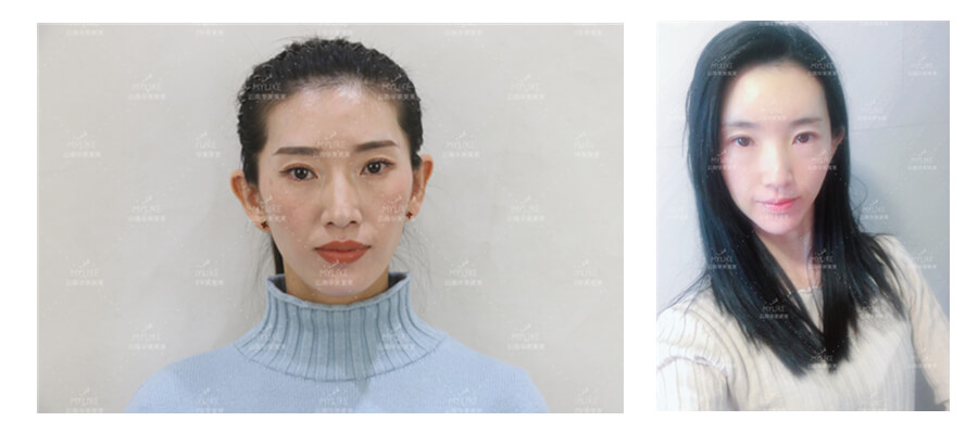 2011年环球游艇模特大赛十佳及单项奖小姐姐必做的医美项目！！利来国际双十一get好物推荐