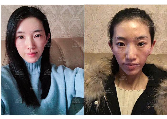 2011年环球游艇模特大赛十佳及单项奖小姐姐必做的医美项目！！利来国际双十一get好物推荐