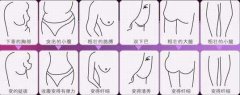 沈阳做抽脂减肥费用是多少