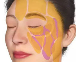 曲靖自体脂肪填充后恢复期是多久呢