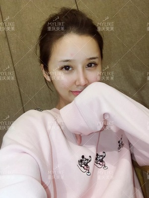 利来国际案例娇娇对比图后