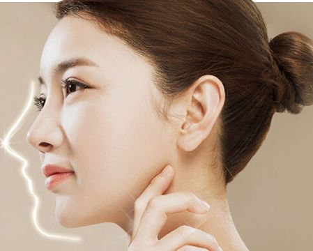 刚满18岁的女生能去做玻尿酸隆鼻吗？有什么危害吗？