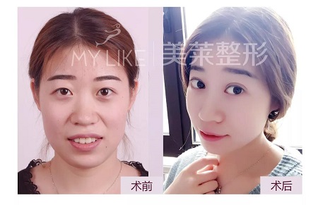 利来国际特邀整形医师—卜胜利主任，