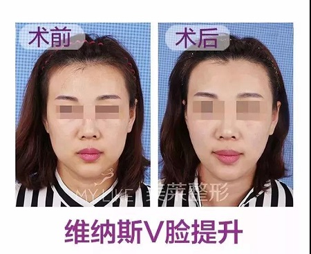 台湾微整医师林冠宏