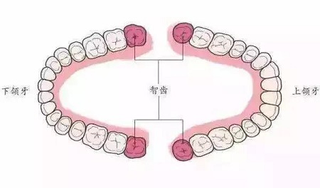 智齿