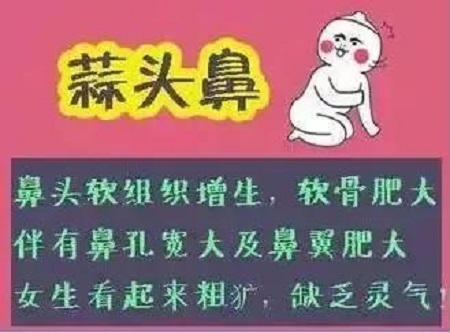 假体隆鼻