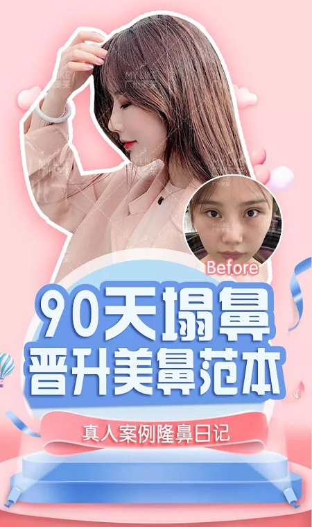 鼻综合