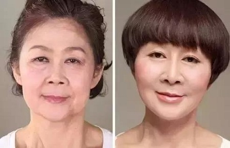除皱
