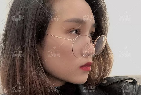 自体脂肪+双眼皮，这对cp你不pick一下吗？