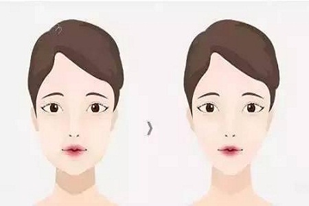 重庆瘦脸效果好不好