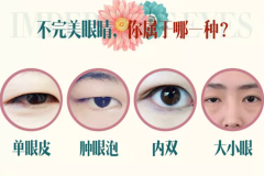 郑州利来国际整形双眼皮多少钱？