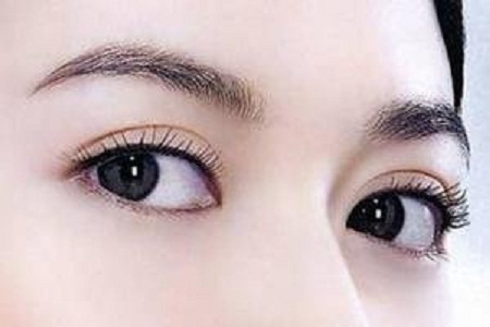 成都利来国际开眼角多少钱